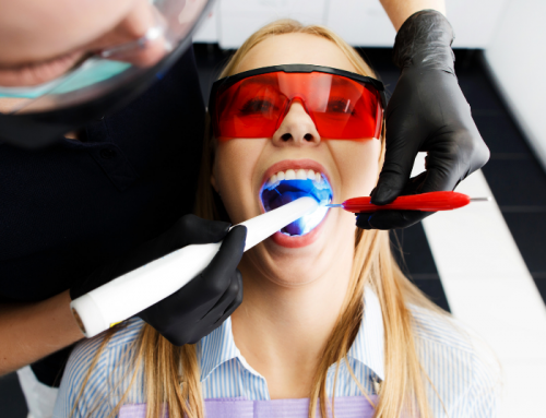 Sbiancamento dentale: cos’è e come si fa