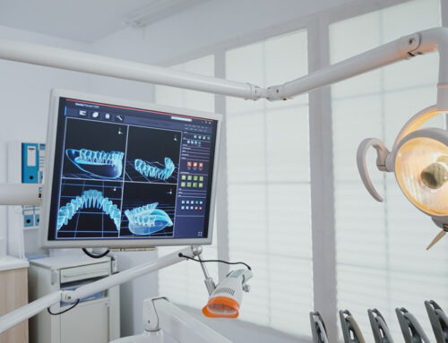 Implantologia computer-assistita: un trattamento dentale innovativo