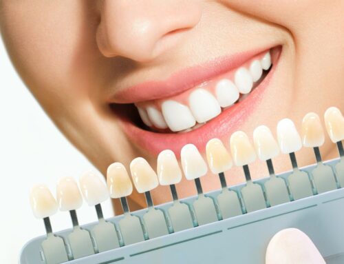 Qual è il colore naturale dei denti?